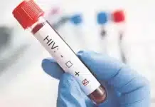 La paciente argentina que eliminó el virus del VIH sin tratamiento